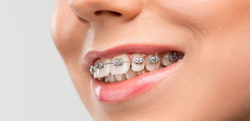Orthodontics