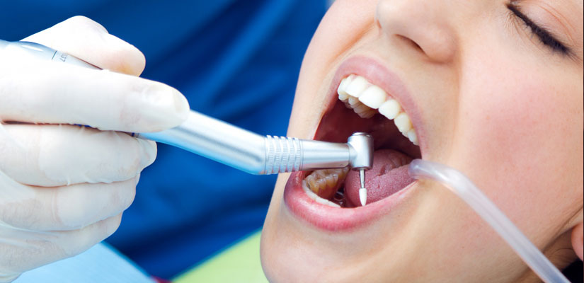 Root Canal Treatment